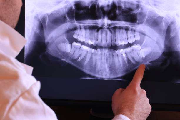 Best Pediatric Emergency Dentist in Freeburg, IL