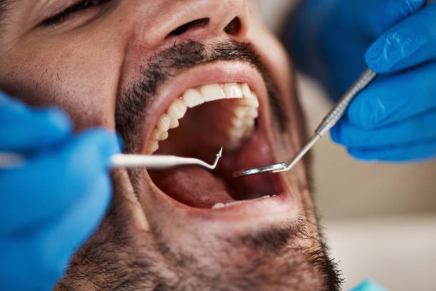 Best Mobile Emergency Dentist in Freeburg, IL